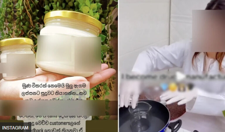 ගෙදර හදන ‘සුදු වෙන ක්‍රීම්’ ගන්න කලින් මේ දේවල් ගැන ඔබ දැනුවත් ද?