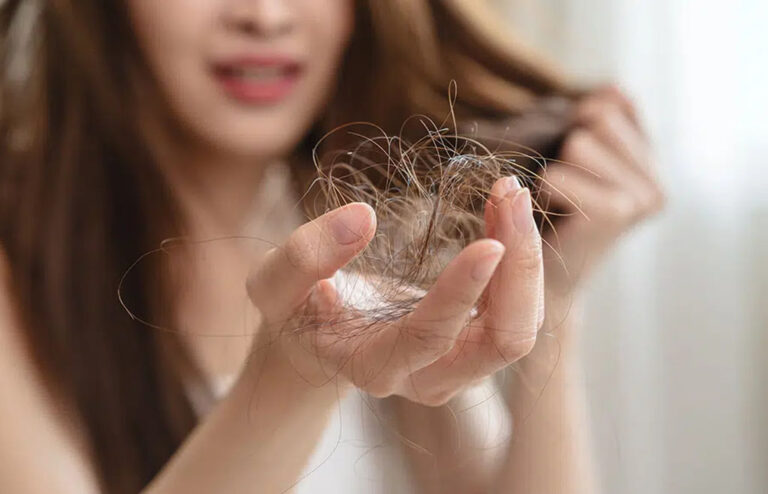 හිසකෙස් ගැලවී යාම නවත්වන්න පුළුවන් ද?