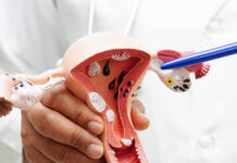 ගැබ්ගෙල පිළිකා රෝගීන්ගෙන් 30%ක් නිරපරාදේ මියයනවා !